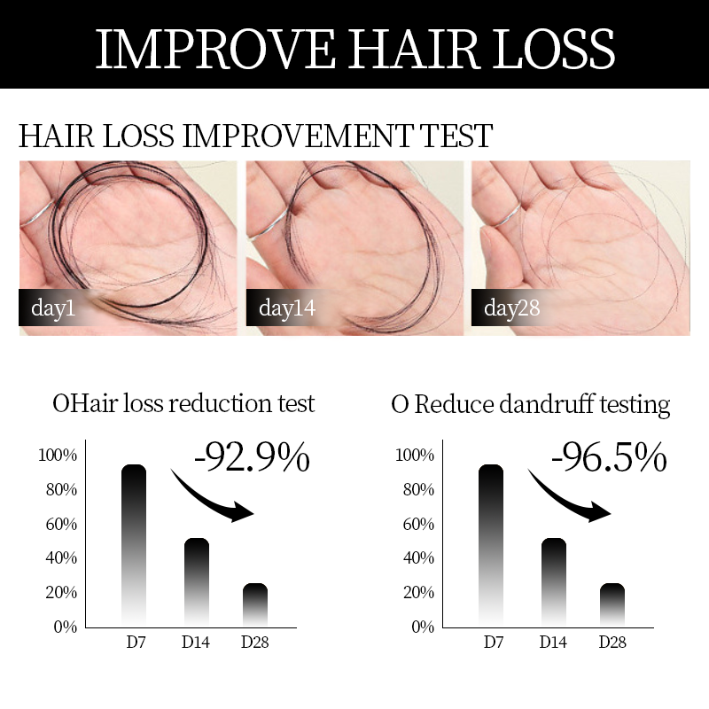 Easter Sale Countdown!⏰DIYSTAR™Root Activator Shampoo- Regain a full head of hair in just 6 weeks!