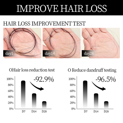 Easter Sale Countdown!⏰DIYSTAR™Root Activator Shampoo- Regain a full head of hair in just 6 weeks!