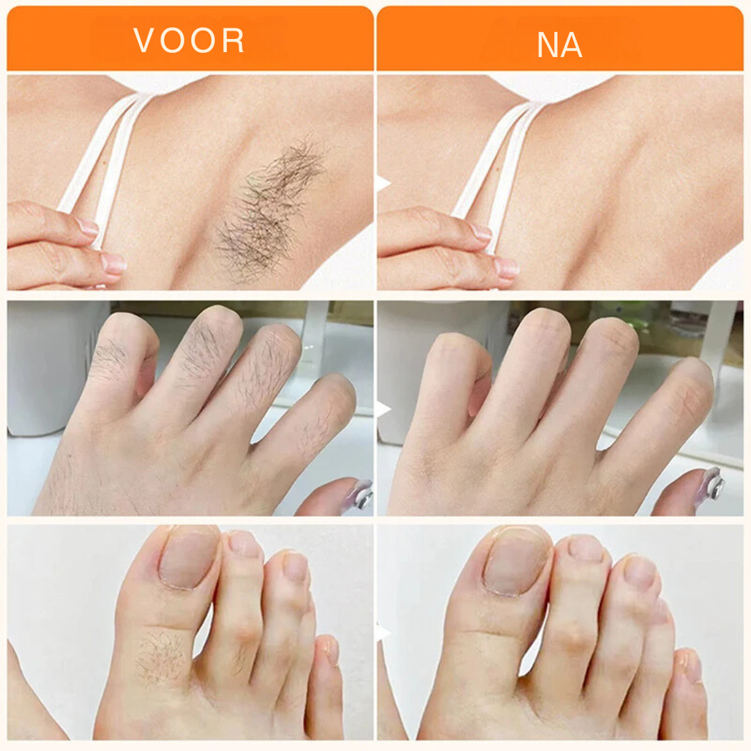 SmoothGlow™ | Verwijder snel ongewenste haren