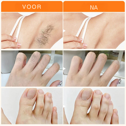 SmoothGlow™ | Verwijder snel ongewenste haren