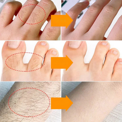 SmoothGlow™ | Verwijder snel ongewenste haren