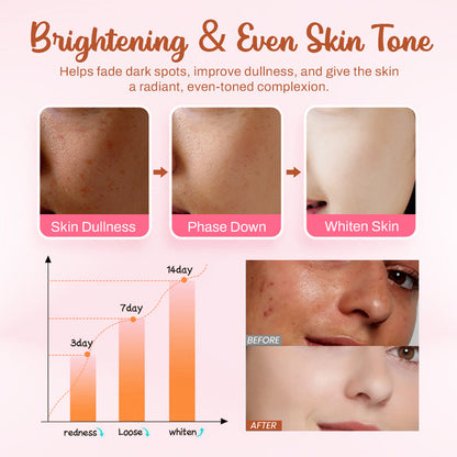 Slimoly™ Whitening and Freckle - Removing Mask