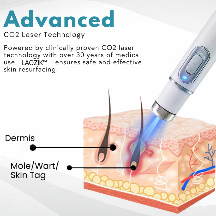 LAOZIK® Non-Invasive Mole and Wart Removal Laser Pen