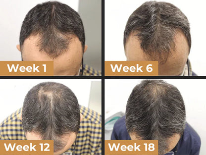 Easter Sale Countdown!⏰DIYSTAR™Root Activator Shampoo- Regain a full head of hair in just 6 weeks!