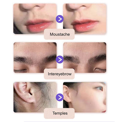 Hoygi™  - Gentle and Painless Facial Hair Removal Cream